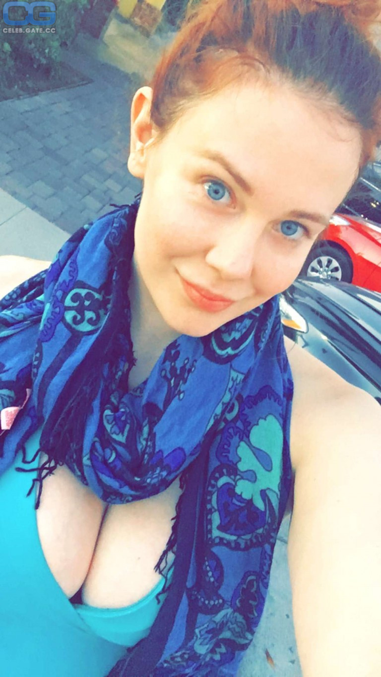 Maitland Ward cleavage