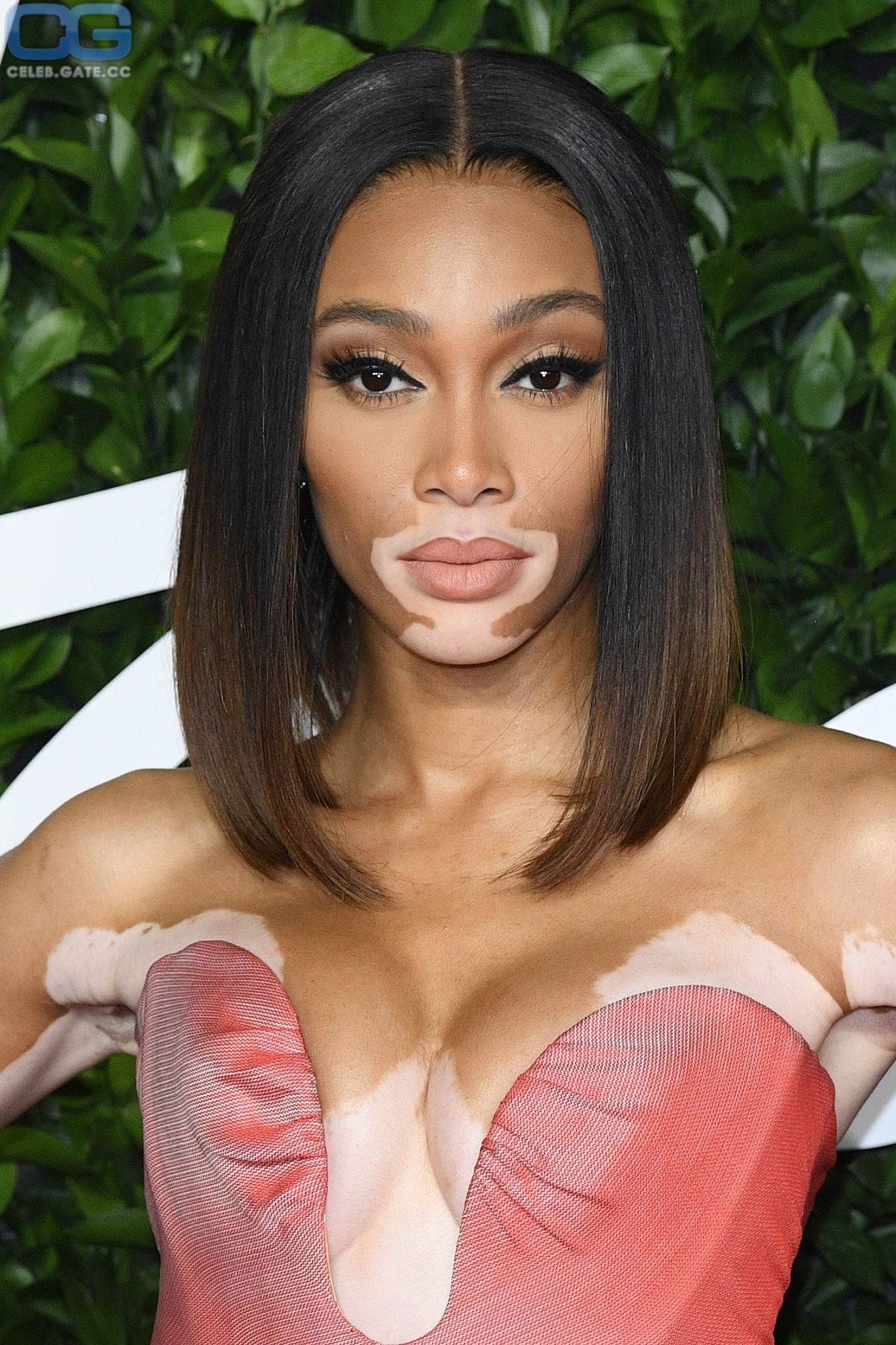 Winnie Harlow 